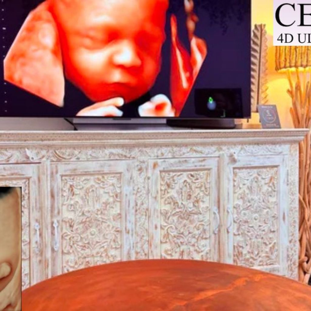 Pregnancy Imaging: Safe, Clear 3D/4D Scans for Every Moment