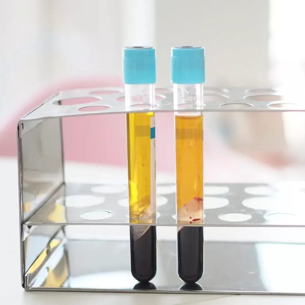 Chemical Peels London | Thecheclinic.co.uk
