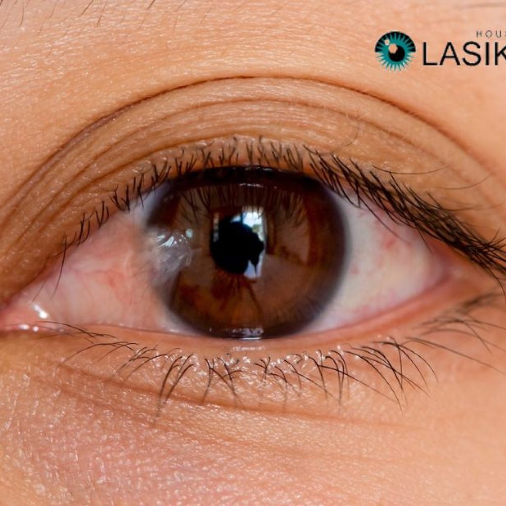 A Practical Guide to Recovering from Pterygium Surgery