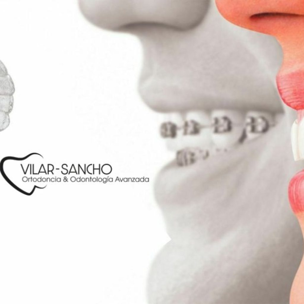 Tu sonrisa perfecta cerca de Pozuelo: especialistas en salud dental