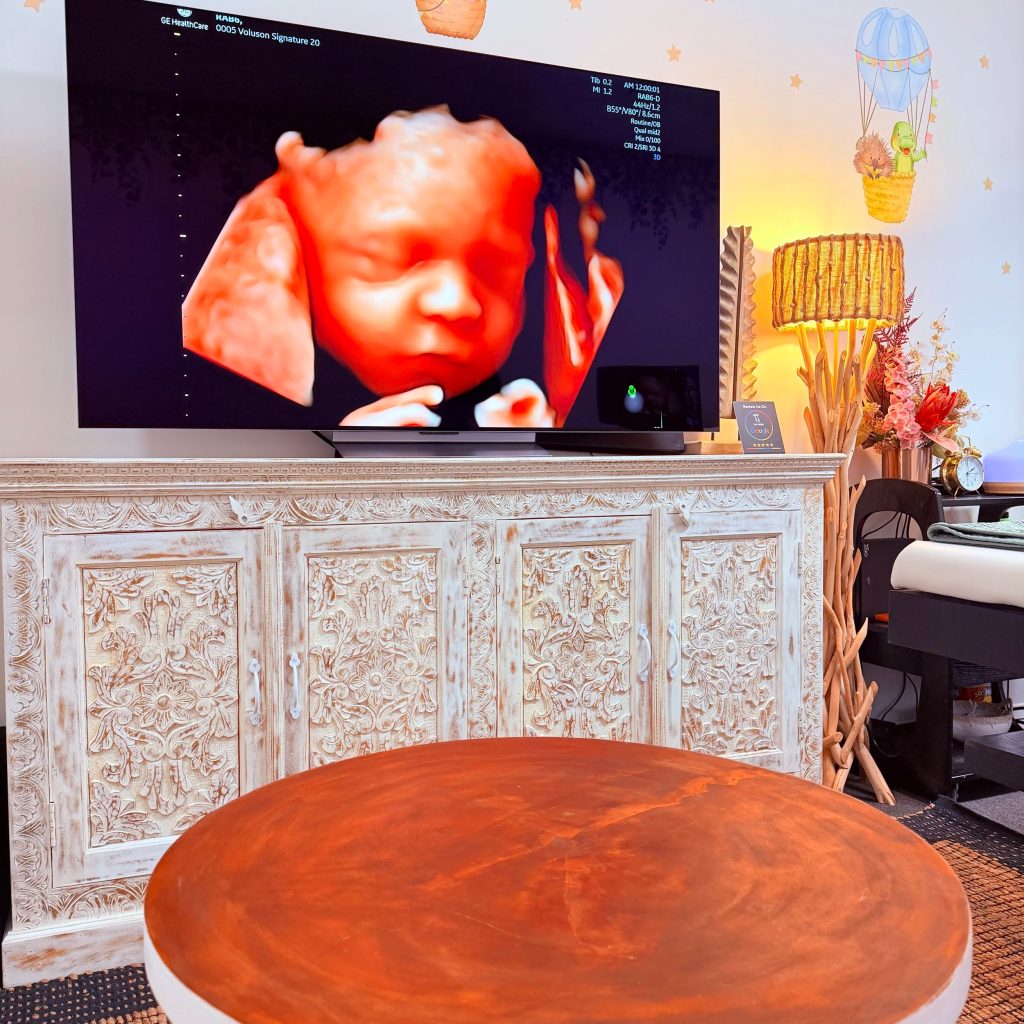Capture Your Baby’s Moments: 3D/4D Ultrasound in Perth