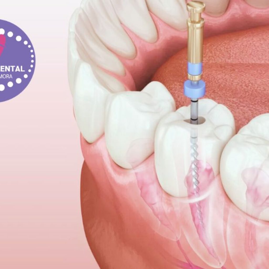 Somriure més brillant a Gines: solucions d’estètica dental