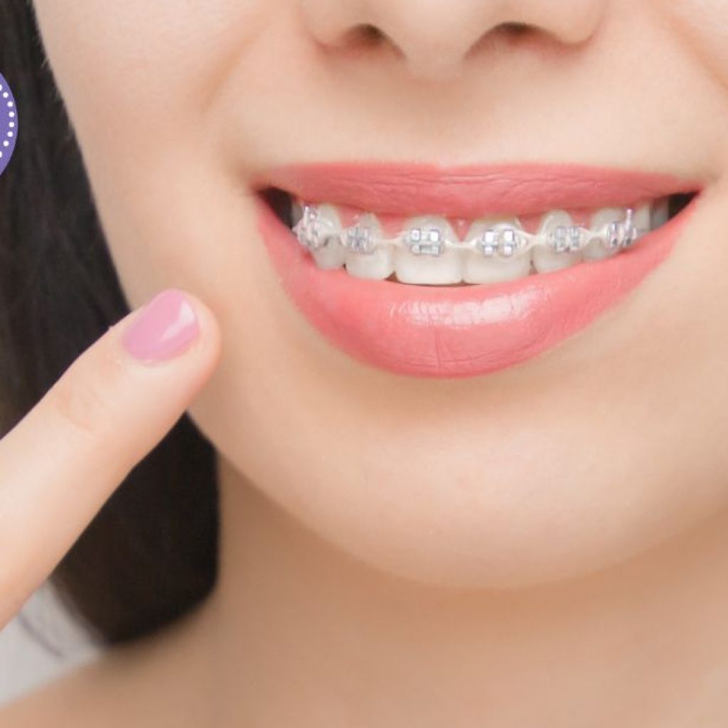 Solucions de dentadura a Gines: pròtesi fiable i natural Solucions de dentadura a Gines: pròtesi fiable i natural