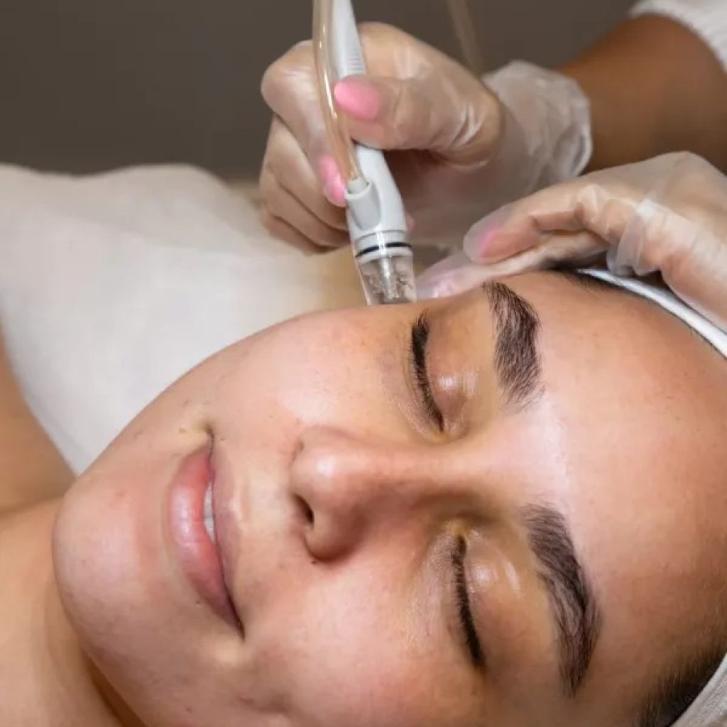 Glow Up: Reveal Radiant Skin with Expert Microdermabrasion in Brampton