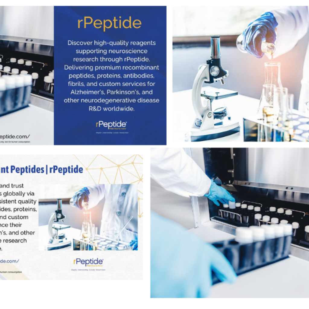 Finding Reliable Beta-Amyloid Research Reagents for Your Studies