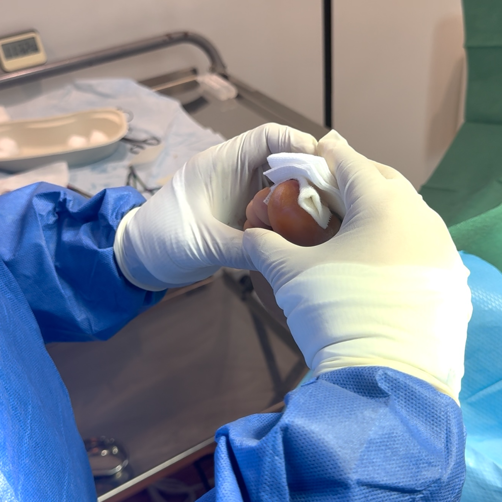 Relieve nail infection with expert surgical treatment Relieve nail infection with expert surgical treatment