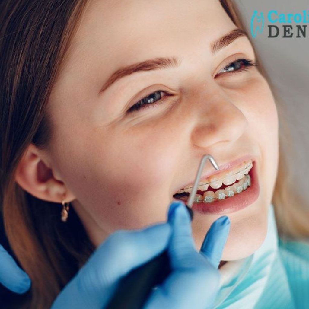 Find Local Clear Aligner Solutions for a Confident Smile