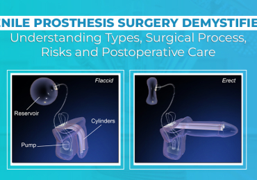 Penile Prosthesis Surgery In Bangalore  | Worldofurology
